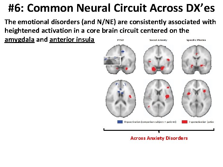 #6: Common Neural Circuit Across DX’es The emotional disorders (and N/NE) are consistently associated