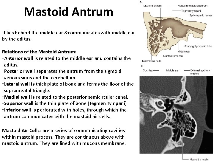 Mastoid Antrum It lies behind the middle ear &communicates with middle ear by the Mastoid Antrum It lies behind the middle ear &communicates with middle ear by the