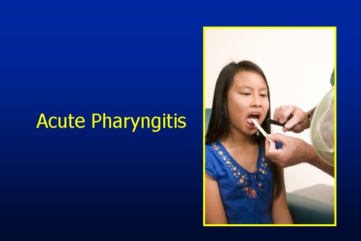 Acute Pharyngitis 