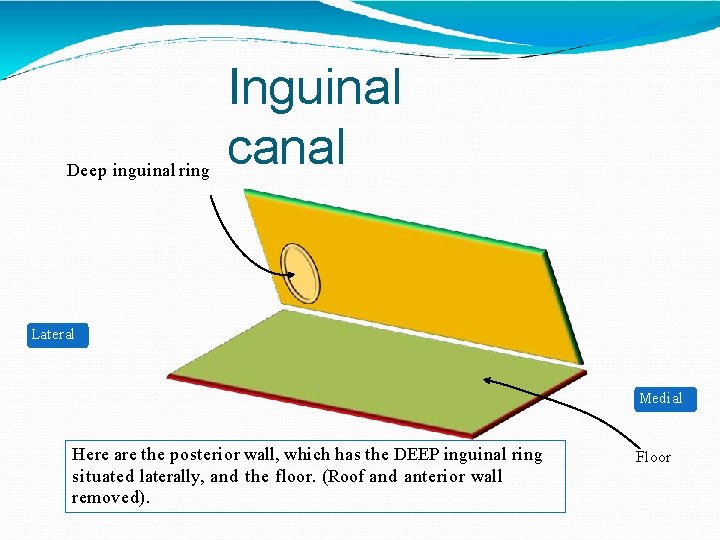 Deep inguinal ring Inguinal canal Lateral Medial Here are the posterior wall, which has