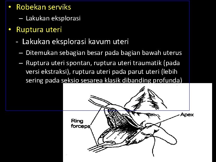 • Robekan serviks – Lakukan eksplorasi • Ruptura uteri - Lakukan eksplorasi kavum • Robekan serviks – Lakukan eksplorasi • Ruptura uteri - Lakukan eksplorasi kavum