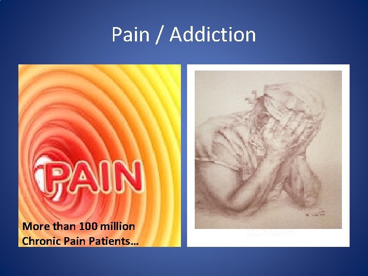 Pain / Addiction More than 100 million Chronic Pain Patients… 