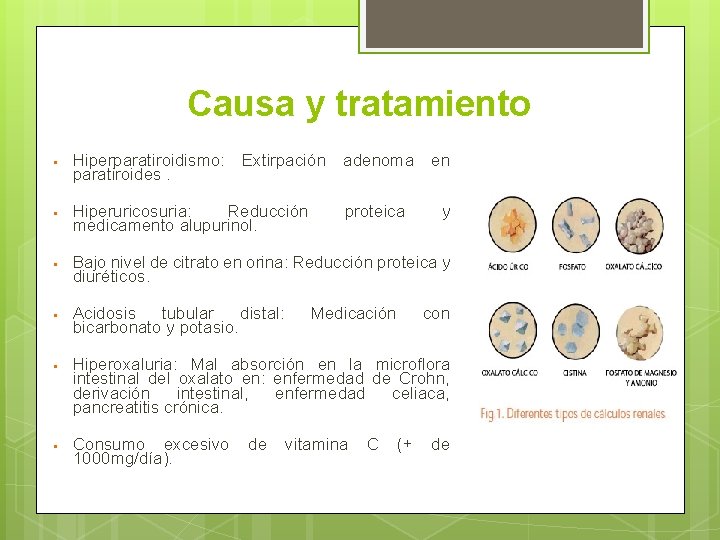 Causa y tratamiento • Hiperparatiroidismo: paratiroides. Extirpación • Hiperuricosuria: Reducción medicamento alupurinol. • Bajo