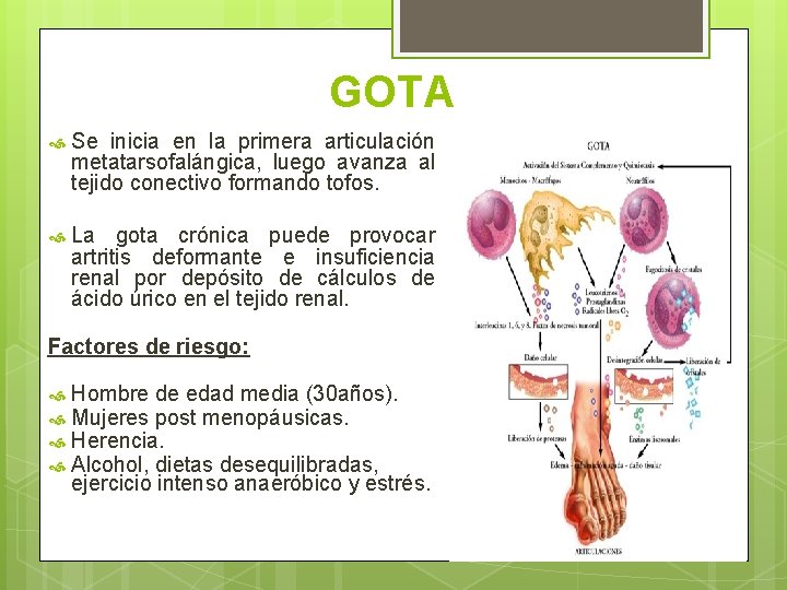 GOTA Se inicia en la primera articulación metatarsofalángica, luego avanza al tejido conectivo formando