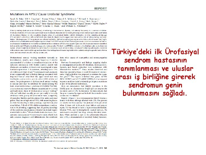 Türkiye’deki ilk Ürofasiyal sendrom hastasının tanımlanması ve uluslar arası iş birliğine girerek sendromun genin