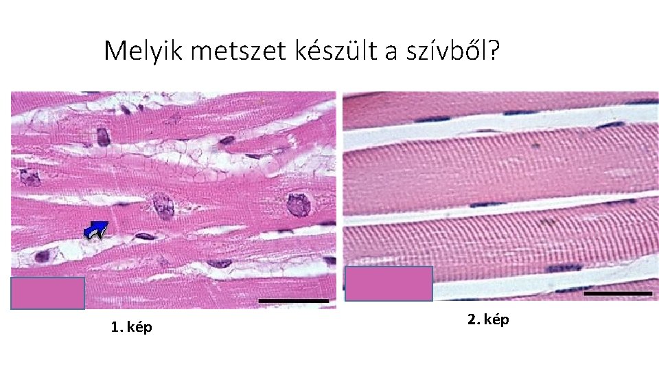 Melyik metszet készült a szívből? 1. kép 2. kép 