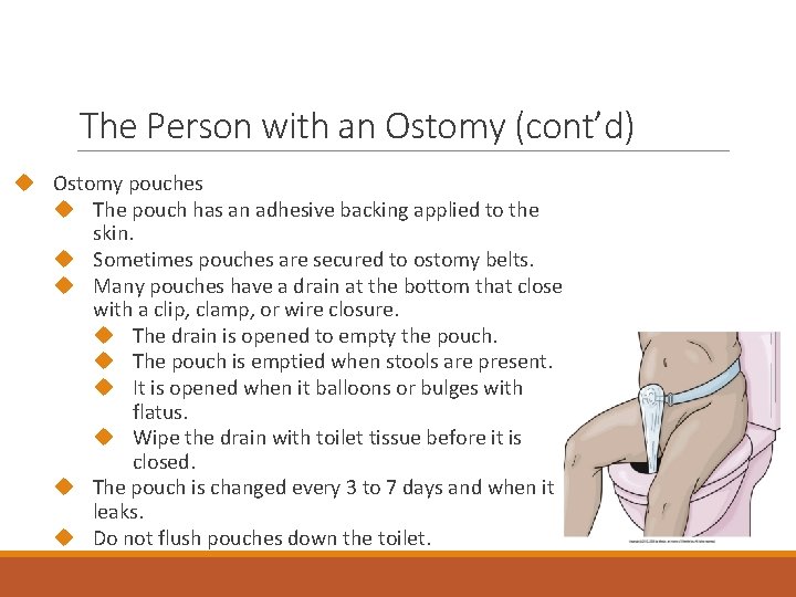 The Person with an Ostomy (cont’d) Ostomy pouches The pouch has an adhesive backing
