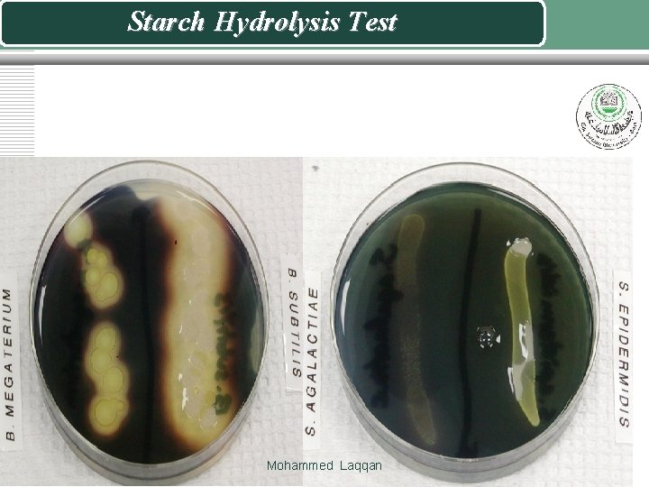 Starch Hydrolysis Test Mohammed Laqqan 