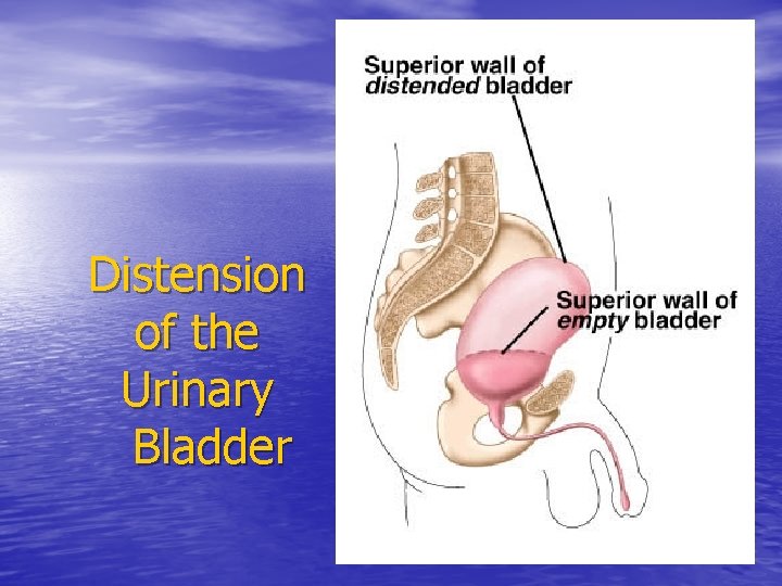 Distension of the Urinary Bladder 