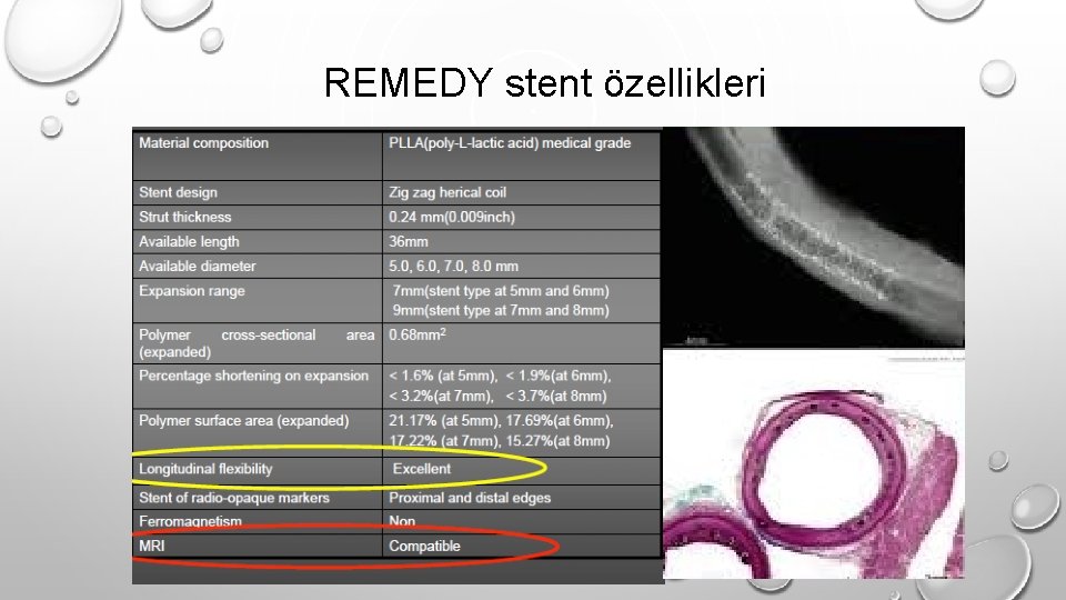 REMEDY stent özellikleri 