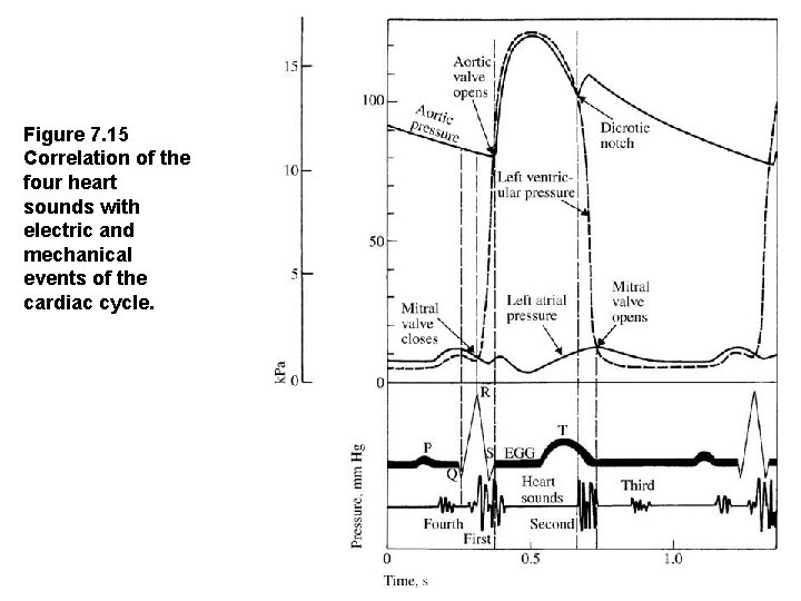 Figure 7. 15  Correlation of the four heart sounds with electric and mechanical events