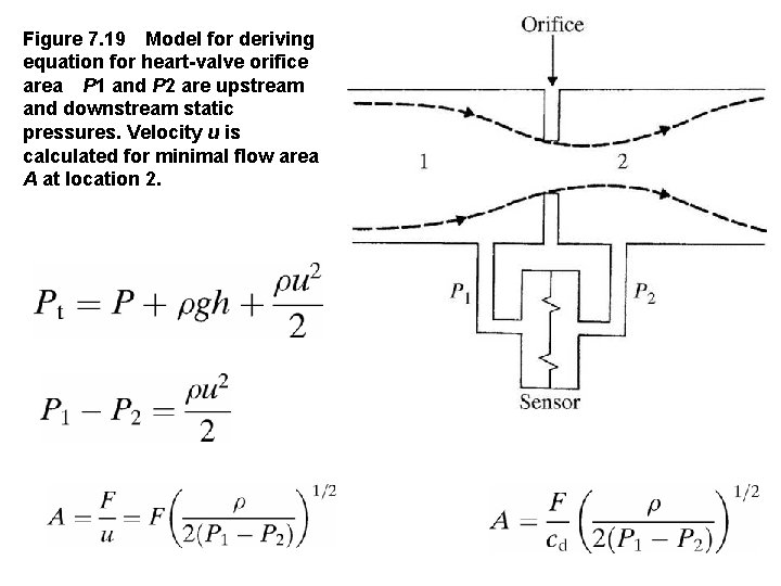 Figure 7. 19 Model for deriving equation for heart valve orifice area P 1 and P