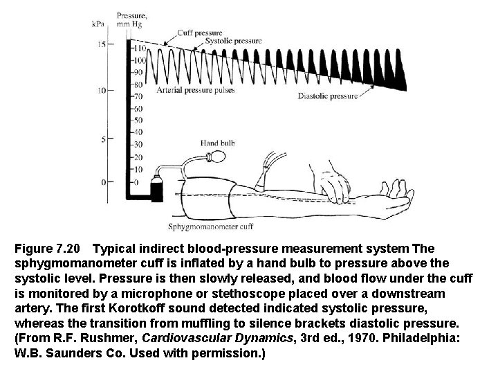 Figure 7. 20 Typical indirect blood pressure measurement system The sphygmomanometer cuff is inflated by