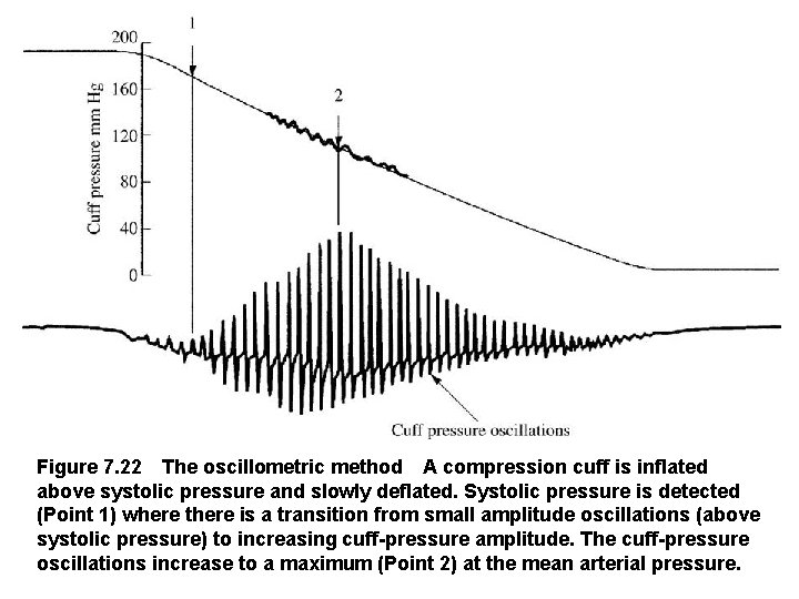 Figure 7. 22 The oscillometric method A compression cuff is inflated above systolic pressure and slowly