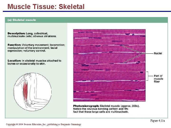 Muscle Tissue: Skeletal § Long, cylindrical, multinucleate cells with obvious striations § Initiates and