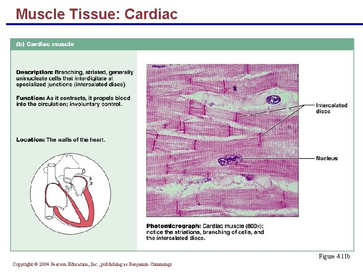 Muscle Tissue: Cardiac § Branching, striated, uninucleate cells interdigitating at intercalated discs § Propels