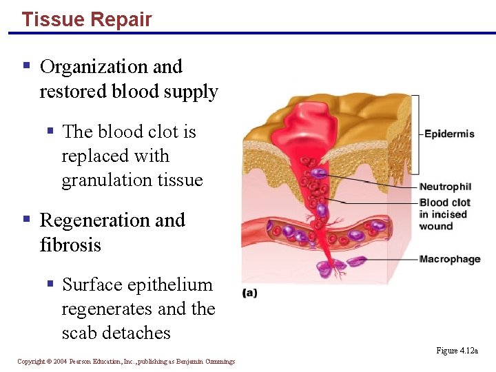 Tissue Repair § Organization and restored blood supply § The blood clot is replaced