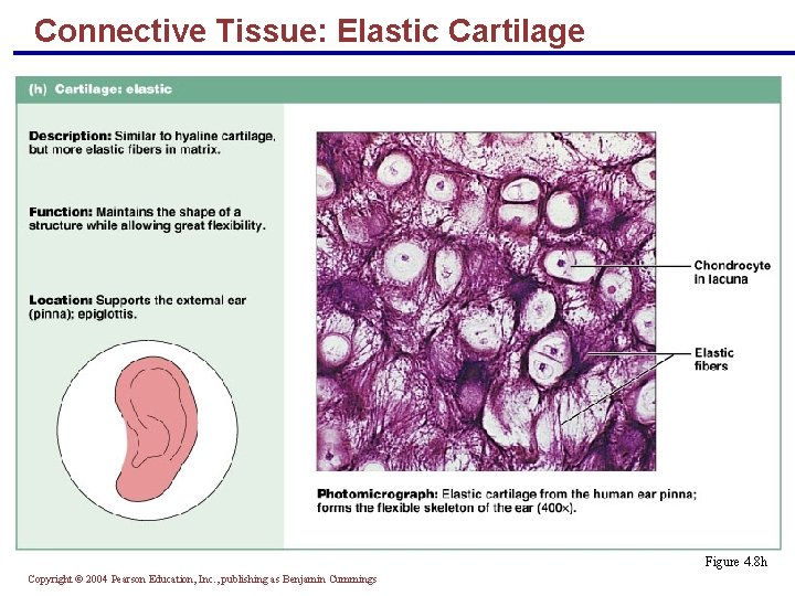 Connective Tissue: Elastic Cartilage § Similar to hyaline cartilage but with more elastic fibers
