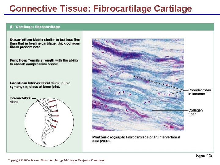 Connective Tissue: Fibrocartilage Cartilage § Matrix similar to hyaline cartilage but less firm with