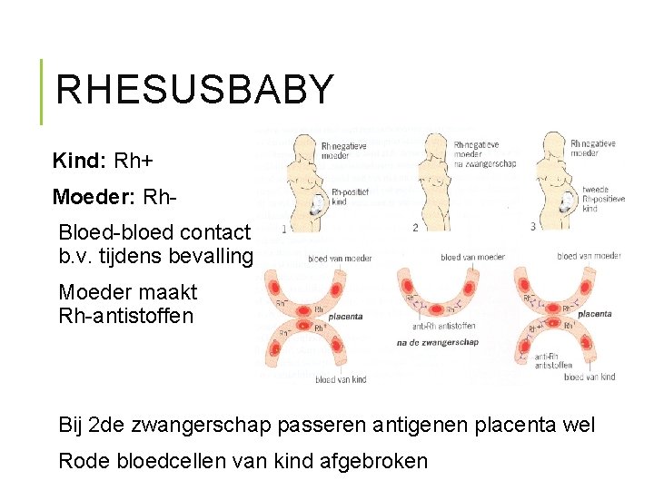 RHESUSBABY Kind: Rh+ Moeder: Rh. Bloed-bloed contact b. v. tijdens bevalling Moeder maakt Rh-antistoffen