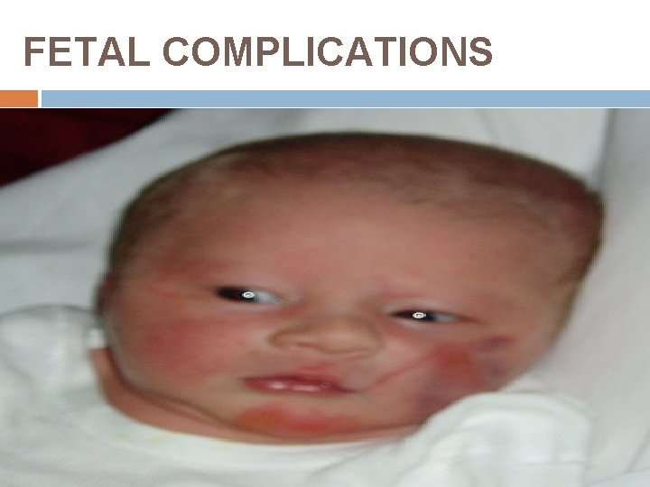 FETAL COMPLICATIONS 