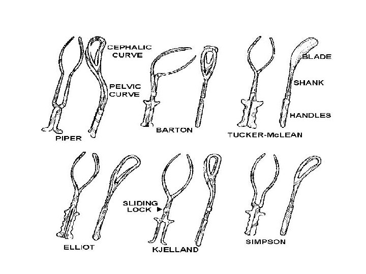 FORCEPS DEFINITION Obstetrics forceps is a pair of