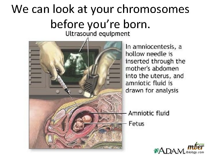 We can look at your chromosomes before you’re born. www. modelbasedbiology. com 