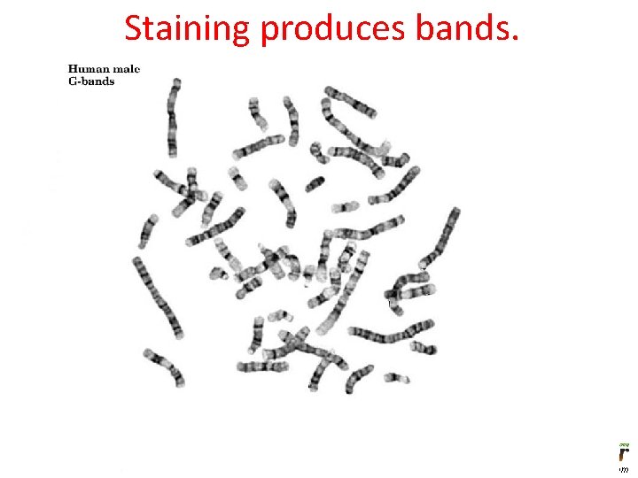 Staining produces bands. www. modelbasedbiology. com 