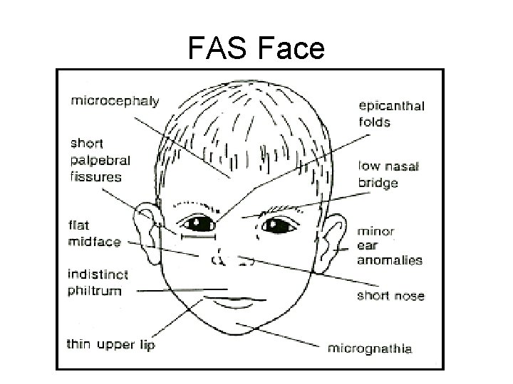 FAS Face 