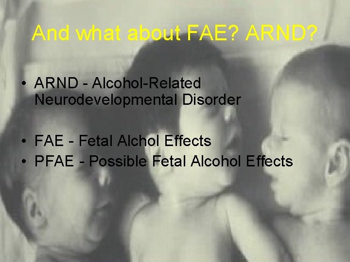 And what about FAE? ARND? • ARND - Alcohol-Related Neurodevelopmental Disorder • FAE -