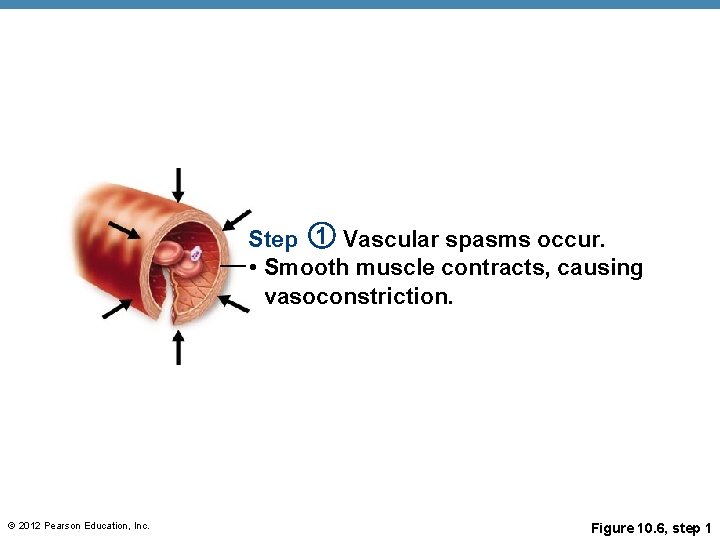 Step 1 Vascular spasms occur. • Smooth muscle contracts, causing vasoconstriction. © 2012 Pearson