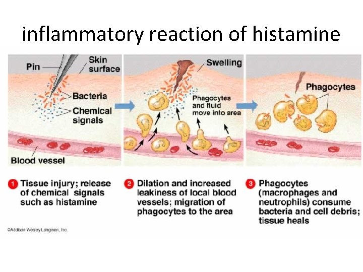 inflammatory reaction of histamine 