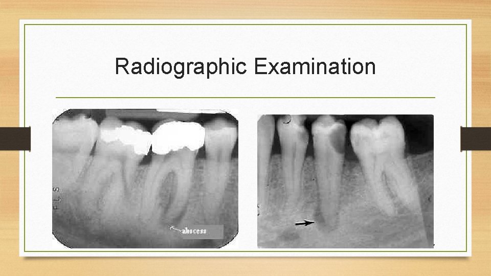 Radiographic Examination 7 