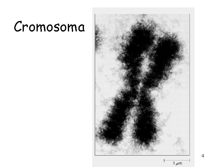 Cromosoma 4 