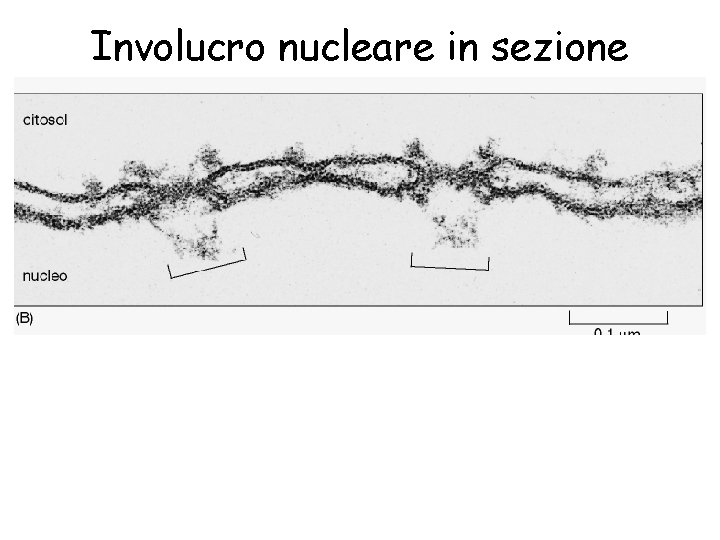 Involucro nucleare in sezione 