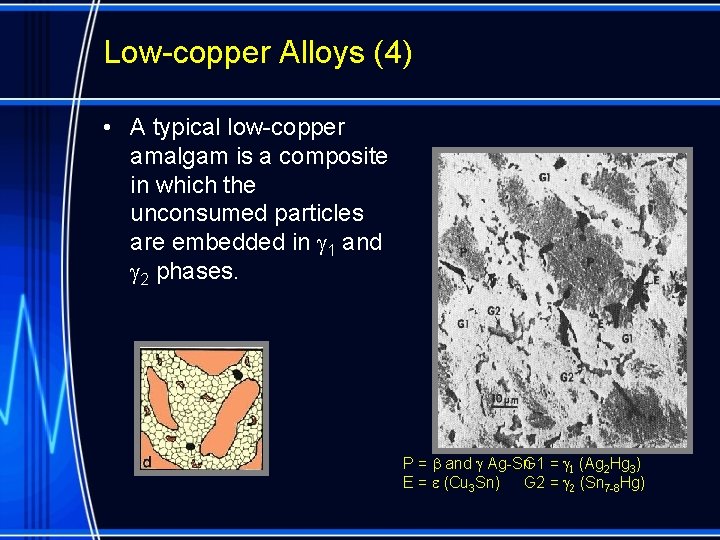 Amalgamation Process Basic Setting Reaction Lowcopper alloys Highcopper