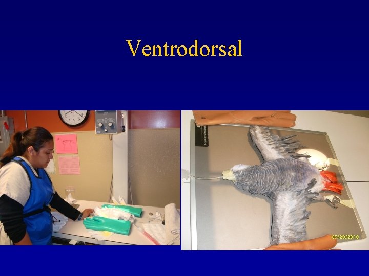 Ventrodorsal 