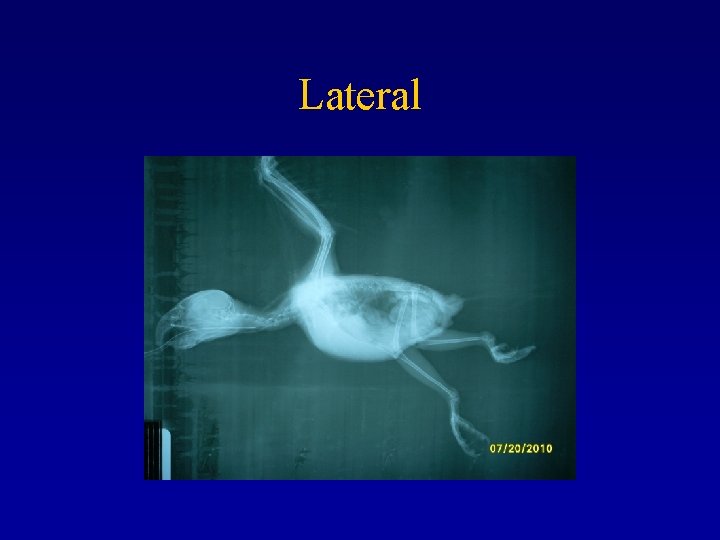 Lateral 