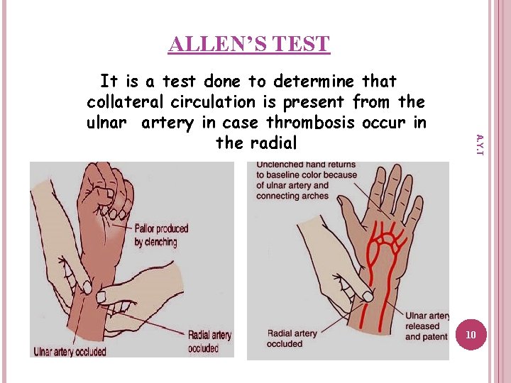 ALLEN’S TEST A. Y. T It is a test done to determine that collateral