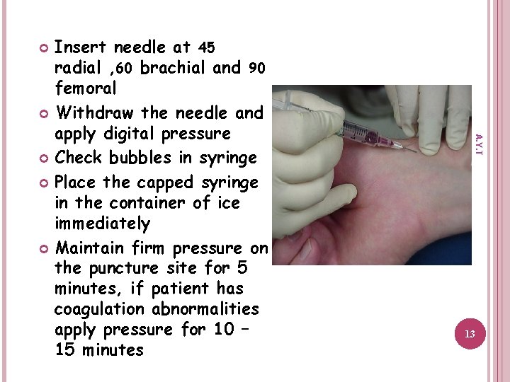 Insert needle at 45 radial , 60 brachial and 90 femoral Withdraw the needle