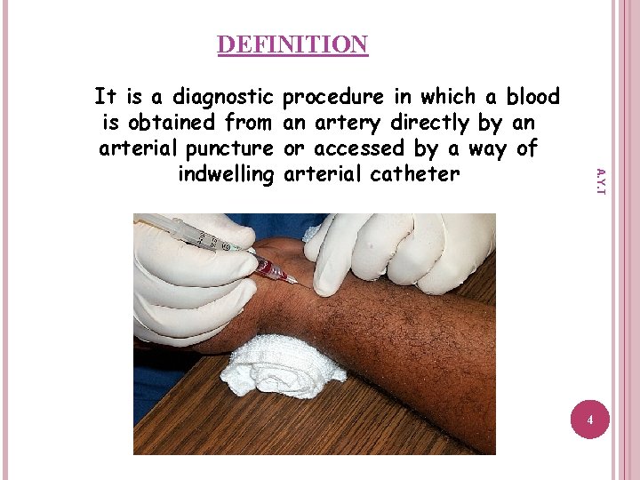 DEFINITION procedure in which a blood an artery directly by an or accessed by