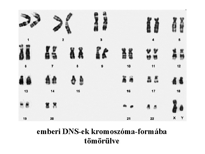 emberi DNS-ek kromoszóma-formába tömörülve 