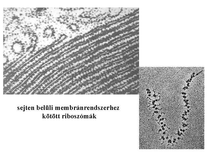 sejten belüli membránrendszerhez kötött riboszómák 