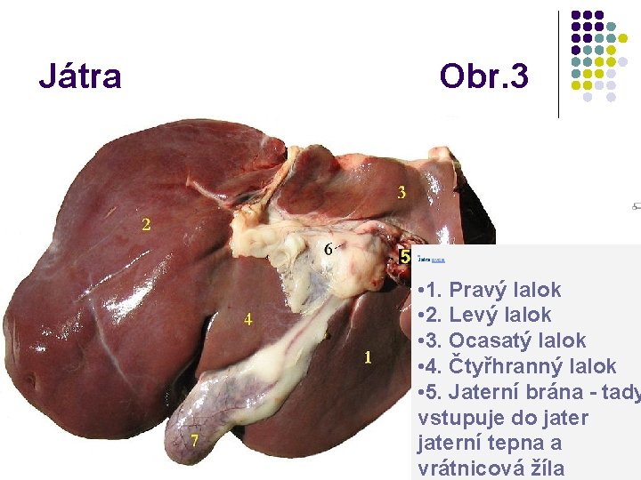 Játra Obr. 3 Játra ovce. • 1. Pravý lalok • 2. Levý lalok •