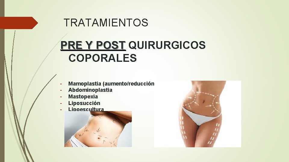 TRATAMIENTOS PRE Y POST QUIRURGICOS COPORALES - Mamoplastia (aumento/reducción) Abdominoplastia Mastopexia Liposucción Lipoescultura 