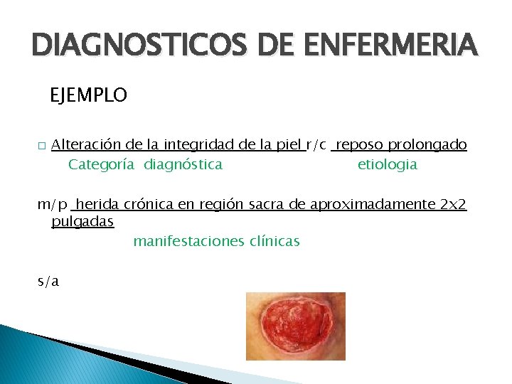 DIAGNOSTICOS DE ENFERMERIA EJEMPLO � Alteración de la integridad de la piel r/c reposo