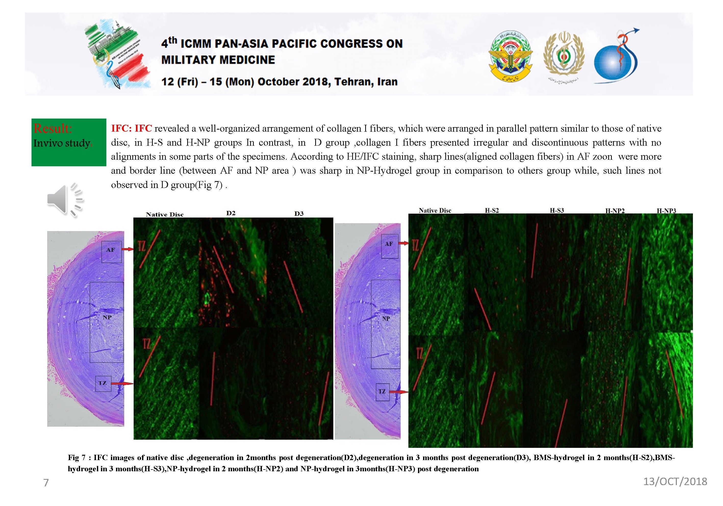 IFC: IFC revealed a well-organized arrangement of collagen I fibers, which were arranged in
