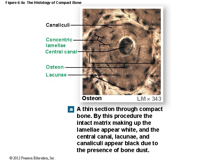 Figure 6 -4 a The Histology of Compact Bone Canaliculi Concentric lamellae Central canal