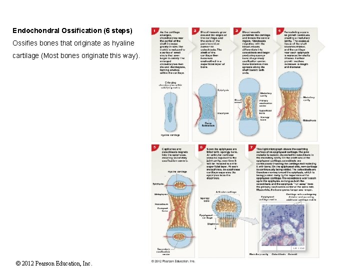 Endochondral Ossification (6 steps) Ossifies bones that originate as hyaline cartilage (Most bones originate