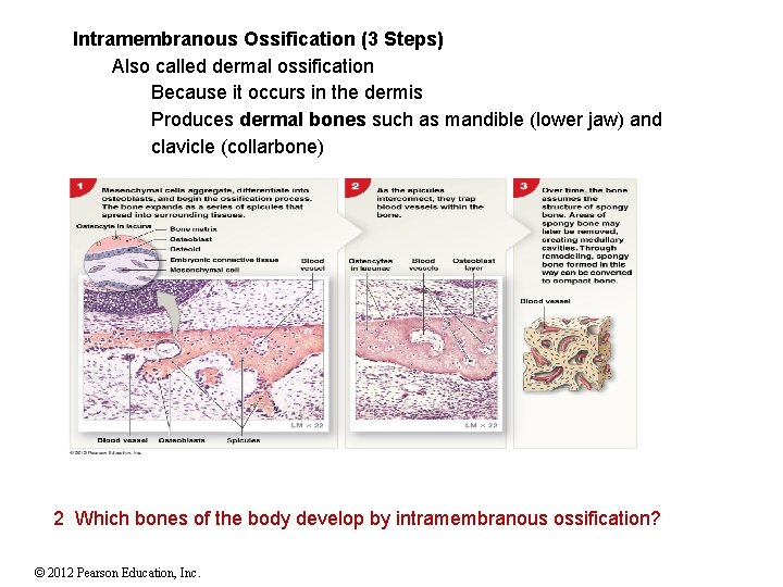 Intramembranous Ossification (3 Steps) Also called dermal ossification Because it occurs in the dermis